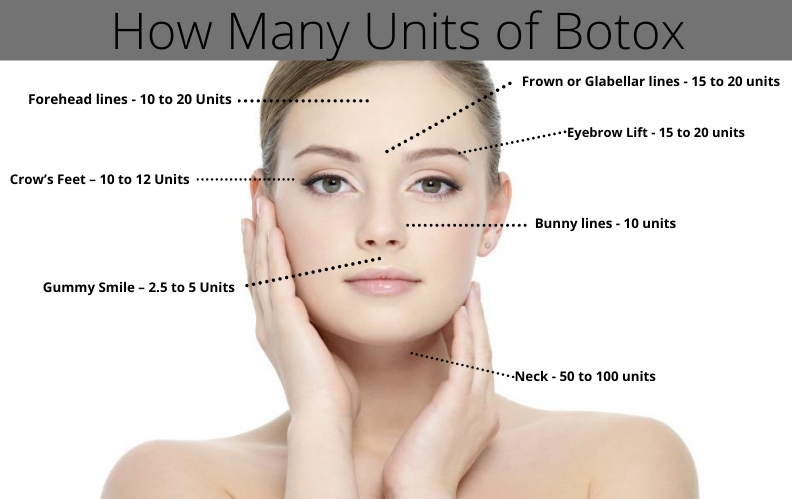 How Many Units Of Botulinum Toxin For Forehead